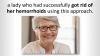 Painless Hemorrhoid Treatment - Want to Find What You Can Really Do to Treat Your Hemorrhoids