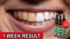 Dentitox Pro Ingredients reviews
